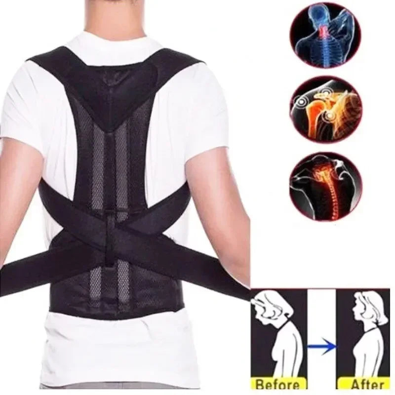"Unisex Posture Corrector for Scoliosis & Kyphosis